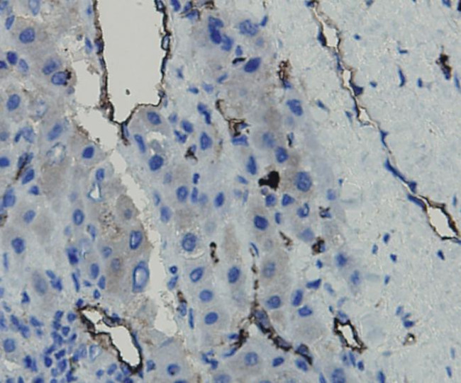 CD34 Antibody in Immunohistochemistry (Paraffin) (IHC (P))