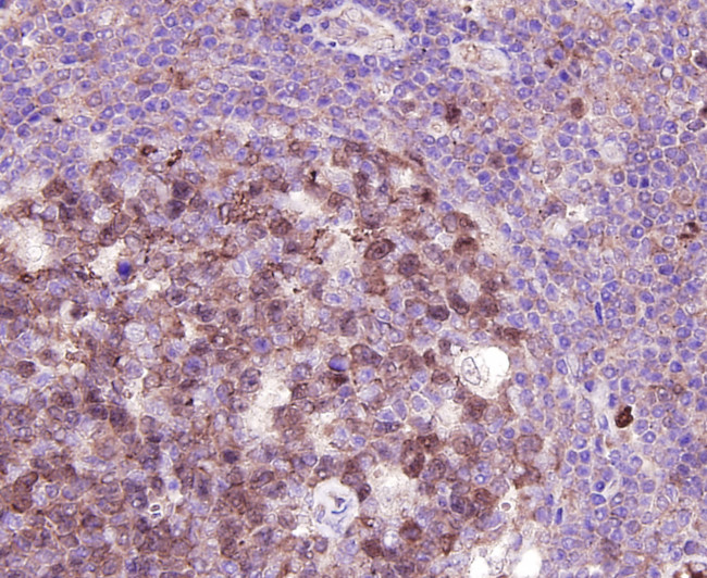 CDK2 Antibody in Immunohistochemistry (Paraffin) (IHC (P))