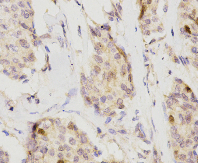 CDK2 Antibody in Immunohistochemistry (Paraffin) (IHC (P))