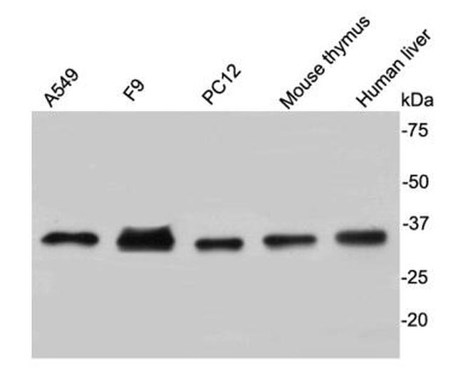 CDK2 Antibody in Western Blot (WB)