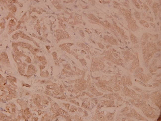 TNFR1 Antibody in Immunohistochemistry (Paraffin) (IHC (P))