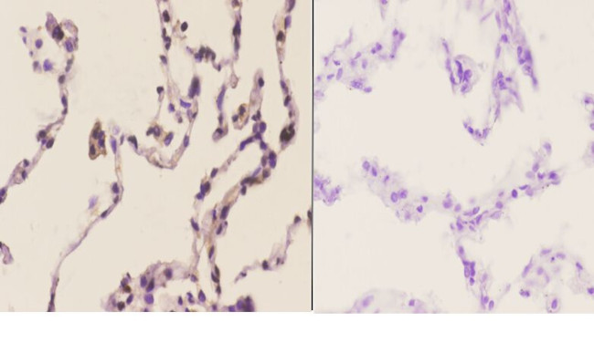 AIF Antibody in Immunohistochemistry (Paraffin) (IHC (P))