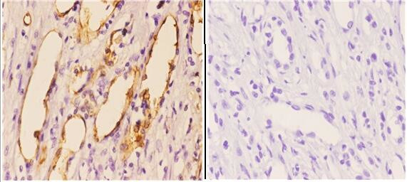 PIK3CA Antibody in Immunohistochemistry (Paraffin) (IHC (P))