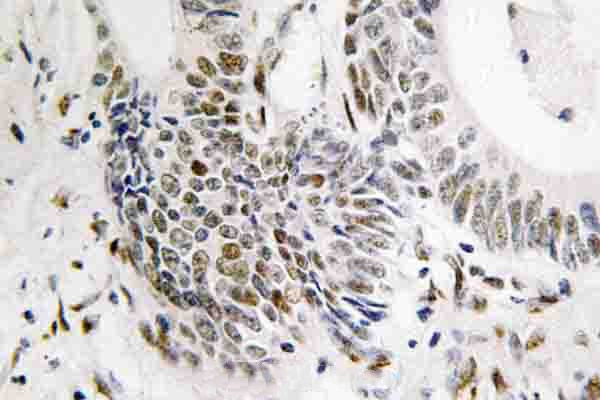 RAD51 Antibody in Immunohistochemistry (Paraffin) (IHC (P))