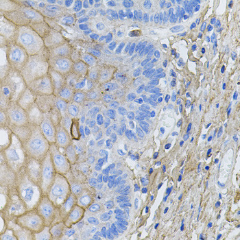 COL1A1 Antibody in Immunohistochemistry (Paraffin) (IHC (P))