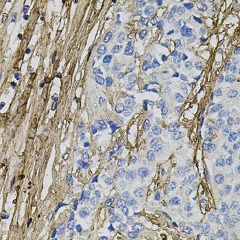 COL1A1 Antibody in Immunohistochemistry (Paraffin) (IHC (P))