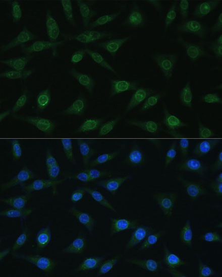 NUP98 Antibody in Immunocytochemistry (ICC/IF)