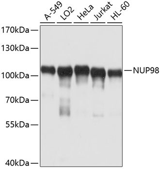 NUP98 Antibody in Western Blot (WB)