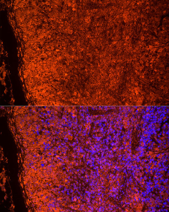 TLR7 Antibody in Immunocytochemistry (ICC/IF)