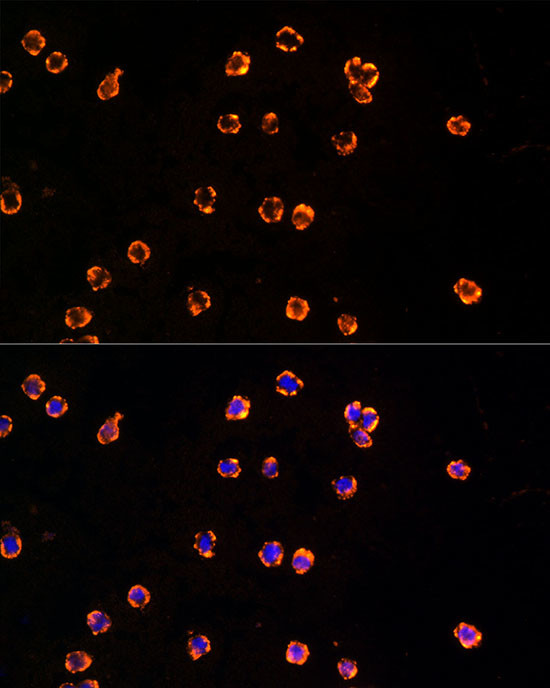 TLR7 Antibody in Immunocytochemistry (ICC/IF)