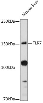 TLR7 Antibody in Western Blot (WB)