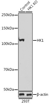 HK1 Antibody in Western Blot (WB)