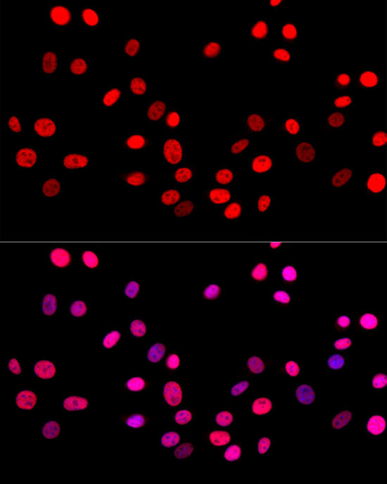 c-Jun Antibody in Immunocytochemistry (ICC/IF)