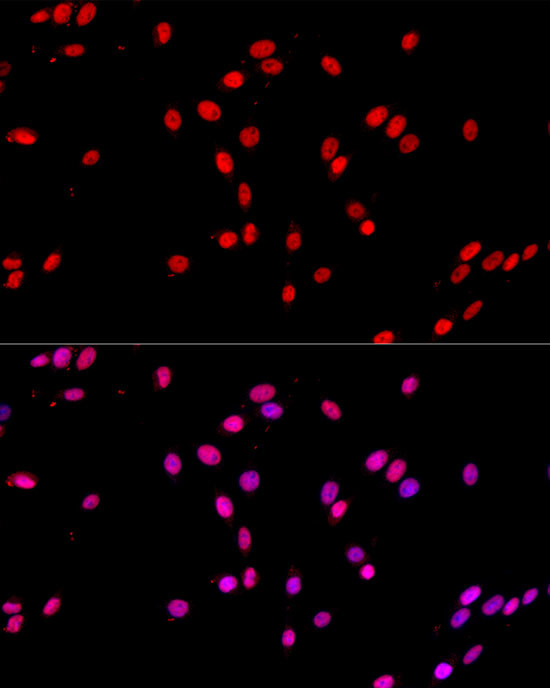 c-Jun Antibody in Immunocytochemistry (ICC/IF)