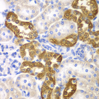 CD151 Antibody in Immunohistochemistry (Paraffin) (IHC (P))