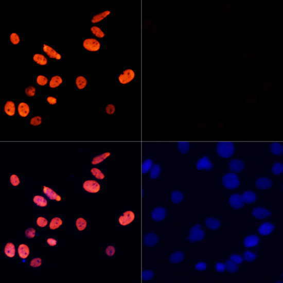 H3K27ac Antibody in Immunocytochemistry (ICC/IF)