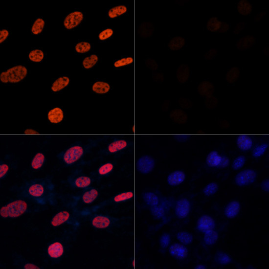 H3K27ac Antibody in Immunocytochemistry (ICC/IF)