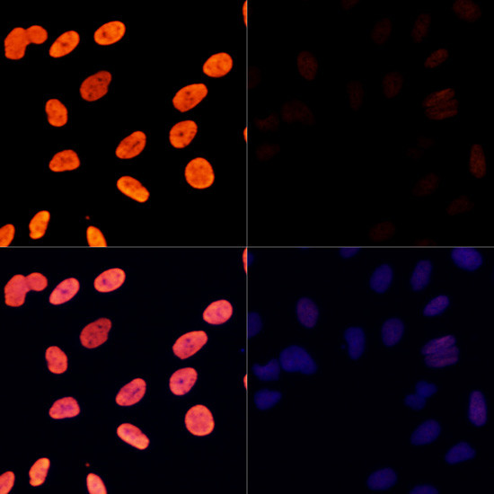 H3K27ac Antibody in Immunocytochemistry (ICC/IF)