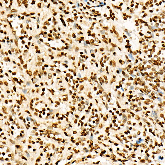 H3K27ac Antibody in Immunohistochemistry (Paraffin) (IHC (P))