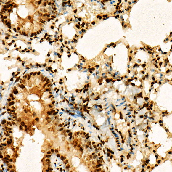 H3K27ac Antibody in Immunohistochemistry (Paraffin) (IHC (P))