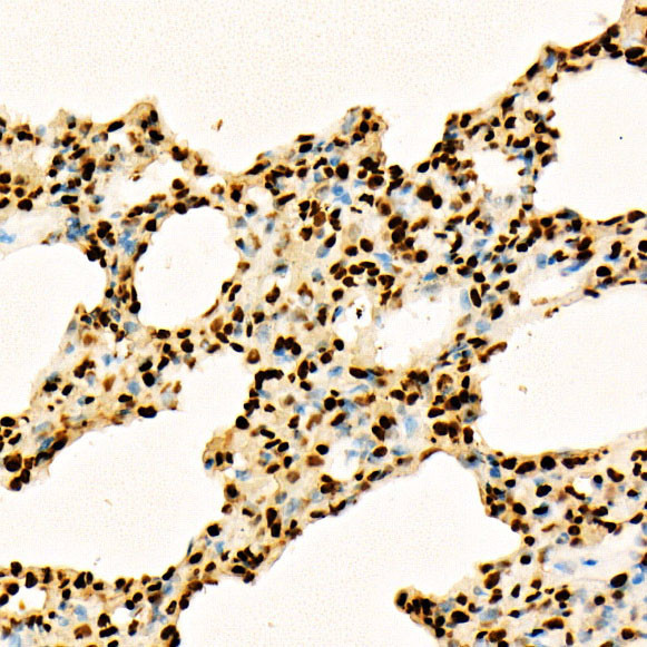 H3K27ac Antibody in Immunohistochemistry (Paraffin) (IHC (P))