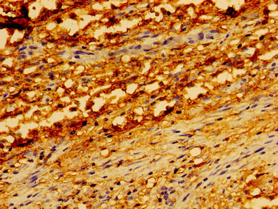 TRADD Antibody in Immunohistochemistry (Paraffin) (IHC (P))