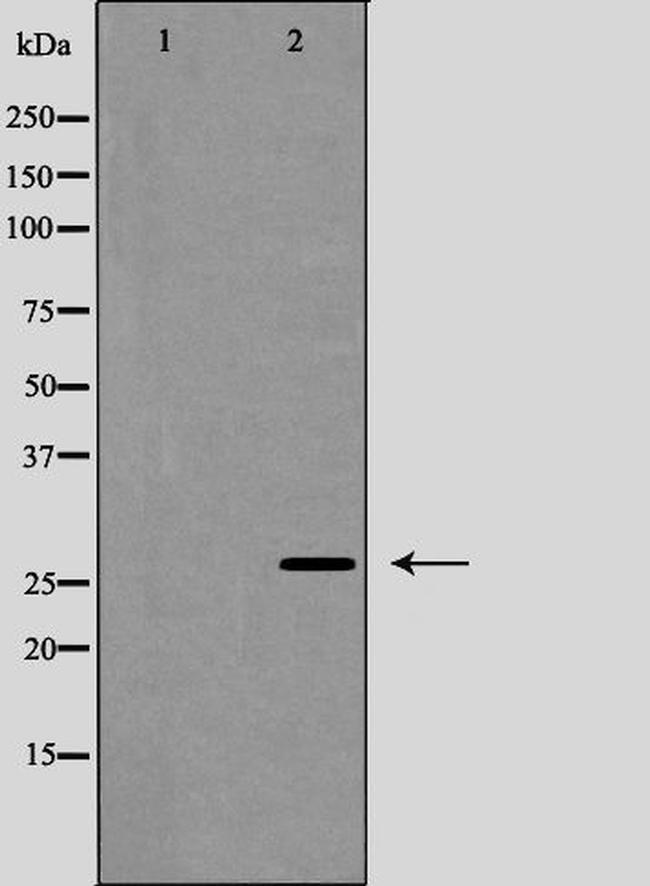 Phospho-Caveolin 2 (Tyr27) Antibody in Western Blot (WB)