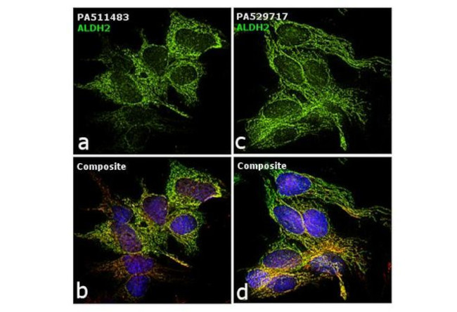 ALDH2 Antibody