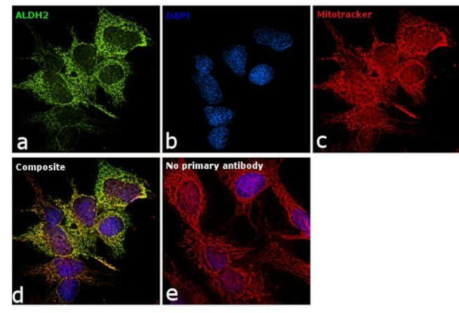 ALDH2 Antibody in Immunocytochemistry (ICC/IF)