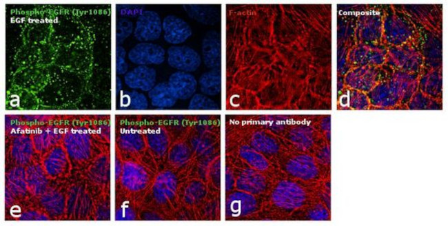 Phospho-EGFR (Tyr1086) Antibody in Immunocytochemistry (ICC/IF)