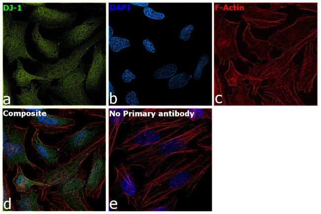 DJ-1 Antibody in Immunocytochemistry (ICC/IF)