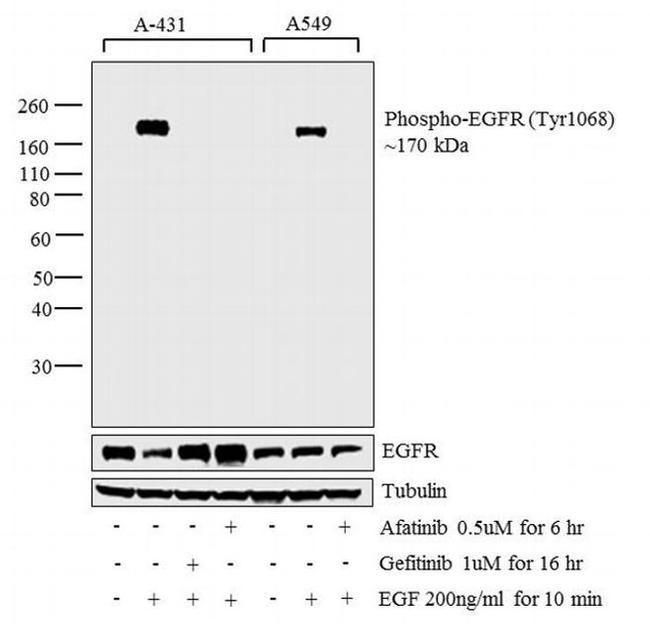 Phospho-EGFR (Tyr1068) Antibody in Western Blot (WB)