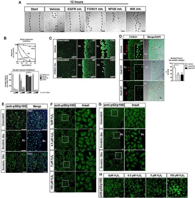 NFkB p100 Antibody in Immunocytochemistry (ICC/IF)