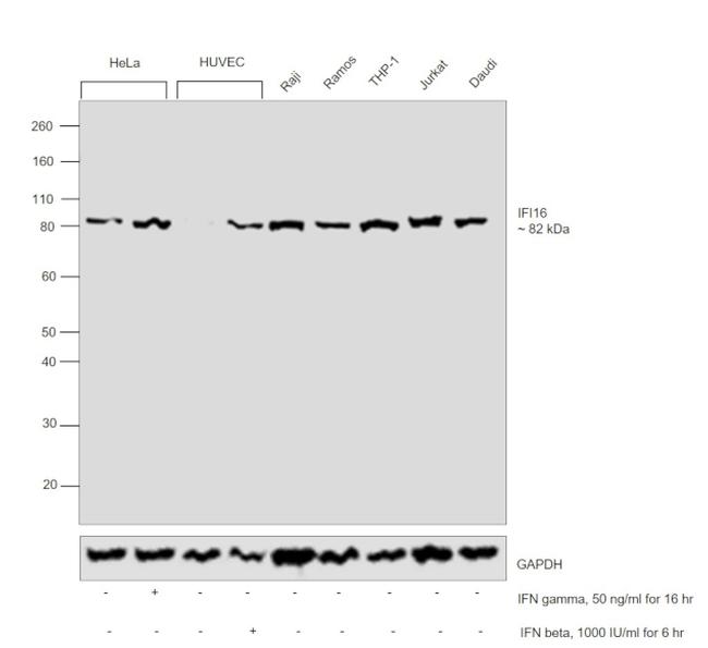 IFI16 Antibody in Western Blot (WB)