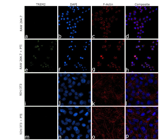 TREM2 Antibody in Immunocytochemistry (ICC/IF)