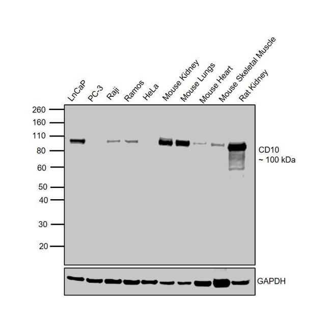 CD10 Antibody in Western Blot (WB)