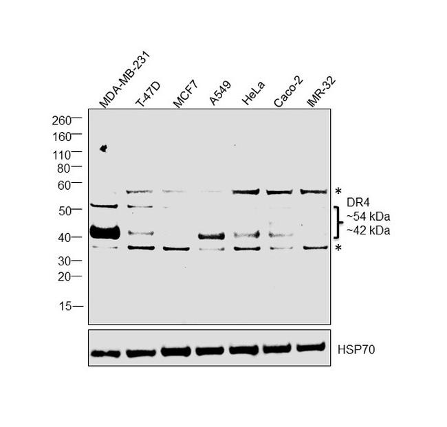 DR4 Antibody in Western Blot (WB)