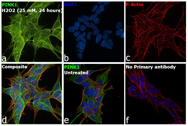 PINK1 Antibody in Immunocytochemistry (ICC/IF)