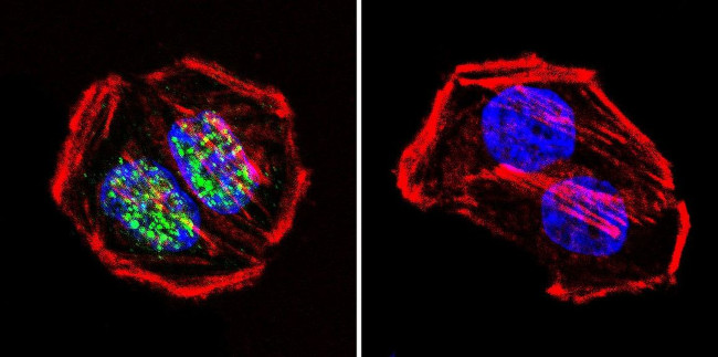 PARP1 Antibody in Immunocytochemistry (ICC/IF)