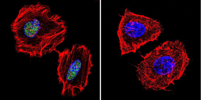 PARP1 Antibody in Immunocytochemistry (ICC/IF)