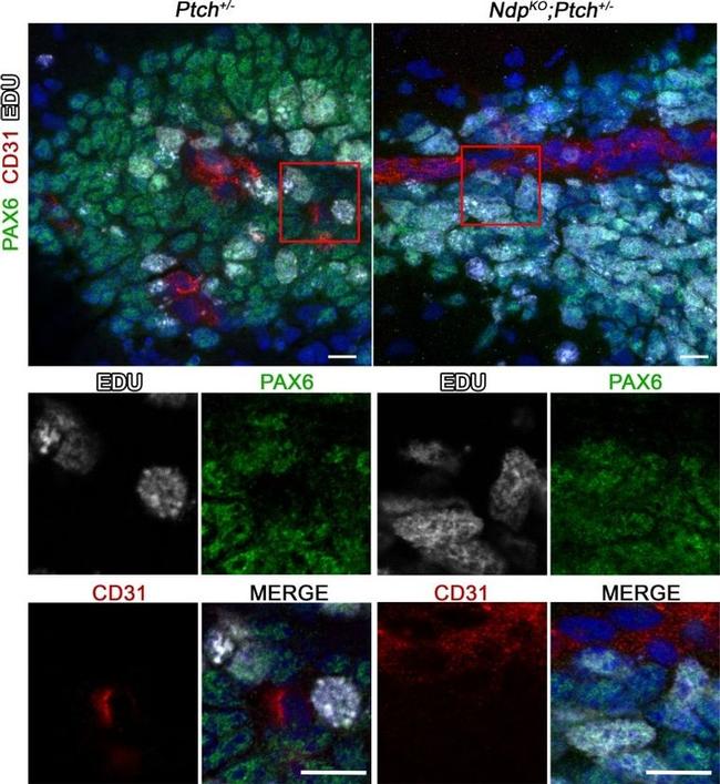 PAX6 Antibody in Immunohistochemistry (IHC)