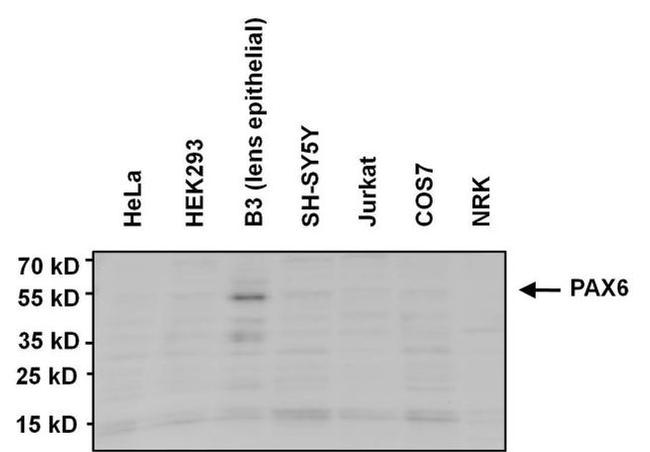 PAX6 Antibody in Western Blot (WB)