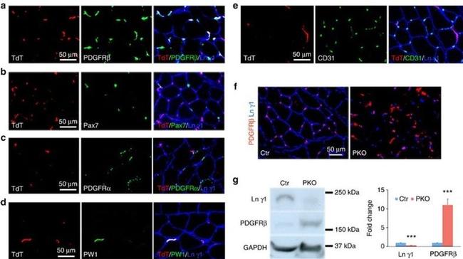 CD140a (PDGFRA) Antibody in Immunohistochemistry (Frozen) (IHC (F))