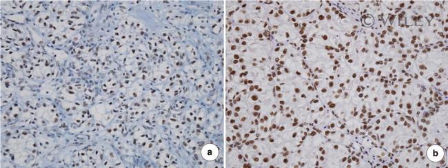 EZH2 Antibody in Immunohistochemistry (Paraffin) (IHC (P))