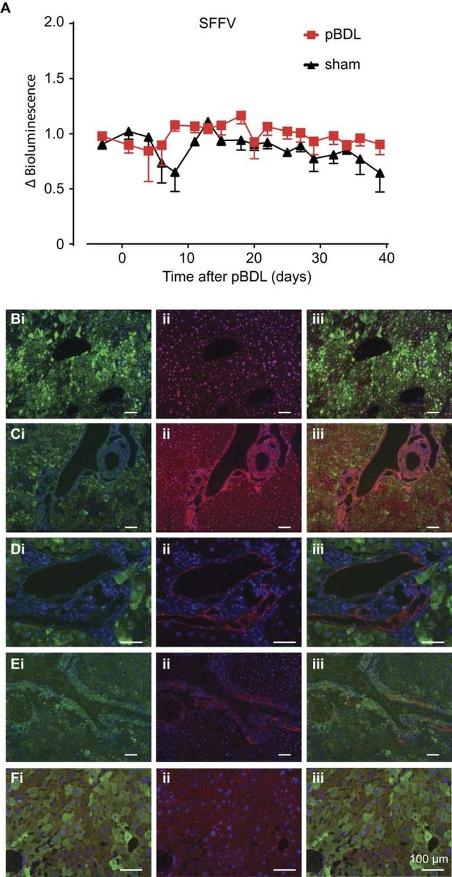 PKM2 Antibody in Immunohistochemistry (IHC)