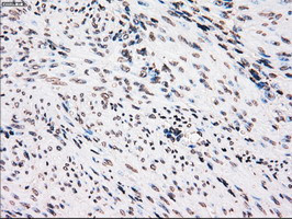 PLK1 Antibody in Immunohistochemistry (Paraffin) (IHC (P))