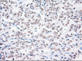 PLK1 Antibody in Immunohistochemistry (Paraffin) (IHC (P))