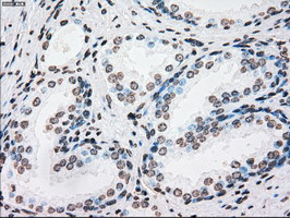 PLK1 Antibody in Immunohistochemistry (Paraffin) (IHC (P))