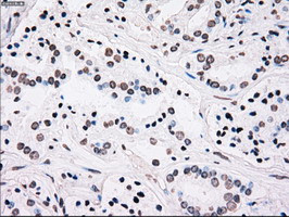 PLK1 Antibody in Immunohistochemistry (Paraffin) (IHC (P))