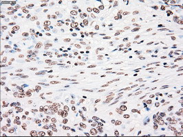 PLK1 Antibody in Immunohistochemistry (Paraffin) (IHC (P))